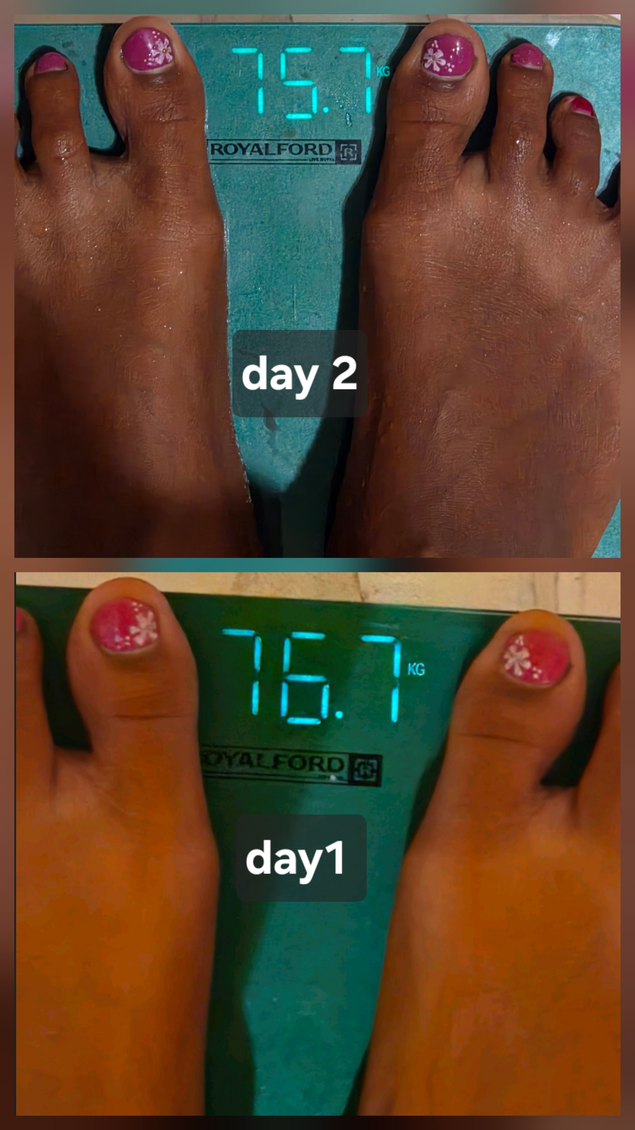 Weight loss Jounery